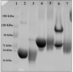 Click here to view Large Figure 3 biomedres-openaccess-journal-bjstr