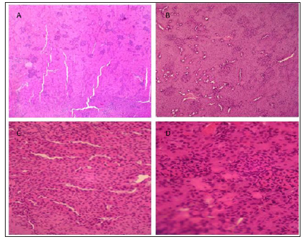 Click here to view Large Figure 1 biomedres-openaccess-journal-bjstr