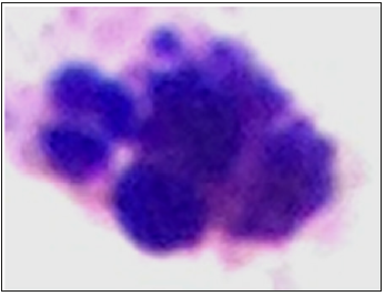 biomedres-openaccess-journal-bjstr