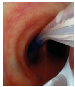 biomedres-openaccess-journal-bjstr