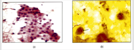 Click here to view Large Figure 1 biomedres-openaccess-journal-bjstr