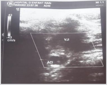 Click here to view Large Figure 2 biomedres-openaccess-journal-bjstr