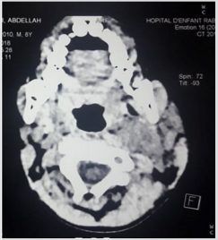 Click here to view Large Figure 3 biomedres-openaccess-journal-bjstr