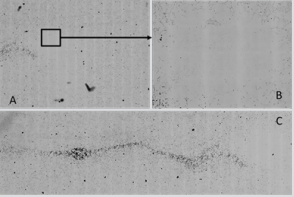 biomedres-openaccess-journal-bjstr