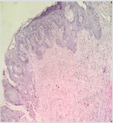 biomedres-openaccess-journal-bjstr