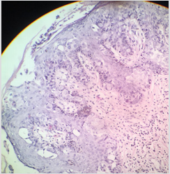 biomedres-openaccess-journal-bjstr