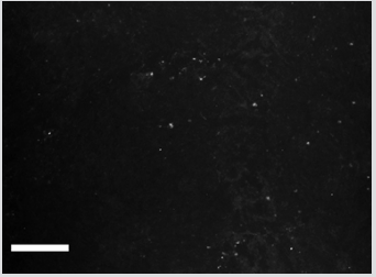 Click here to view Large Figure 2 biomedres-openaccess-journal-bjstr