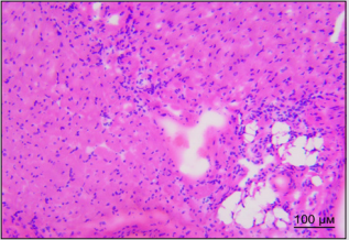 Click here to view Large Figure 3A biomedres-openaccess-journal-bjstr