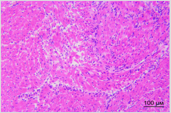 Click here to view Large Figure 3B biomedres-openaccess-journal-bjstr