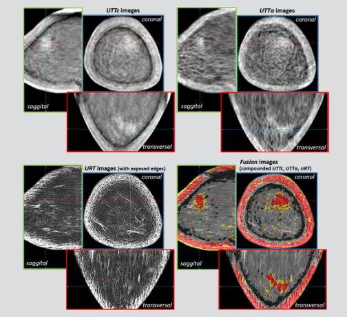 Click here to view Large Figure 3 biomedres-openaccess-journal-bjstr