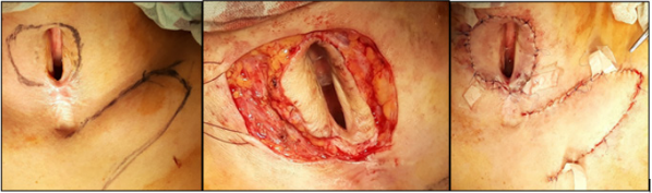 biomedres-openaccess-journal-bjstr