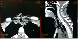 biomedres-openaccess-journal-bjstr