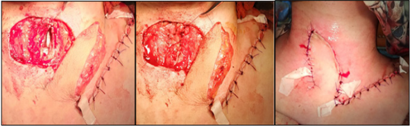 biomedres-openaccess-journal-bjstr