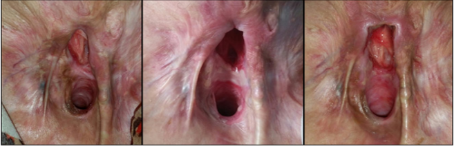 biomedres-openaccess-journal-bjstr