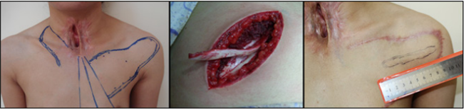 biomedres-openaccess-journal-bjstr