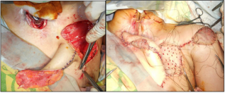 biomedres-openaccess-journal-bjstr