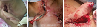 biomedres-openaccess-journal-bjstr