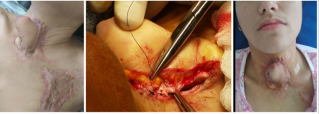 biomedres-openaccess-journal-bjstr