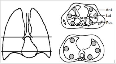 biomedres-openaccess-journal-bjstr