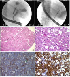 biomedres-openaccess-journal-bjstr