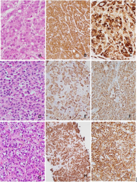 biomedres-openaccess-journal-bjstr