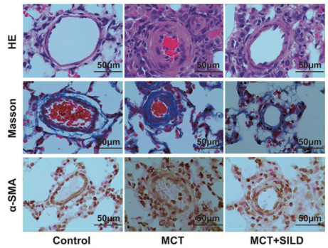 biomedres-openaccess-journal-bjstr