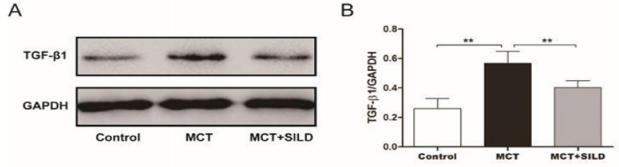 biomedres-openaccess-journal-bjstr
