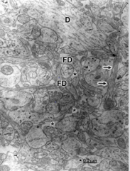 biomedres-openaccess-journal-bjstr