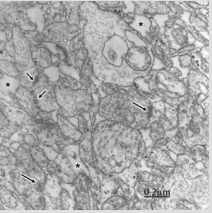 biomedres-openaccess-journal-bjstr