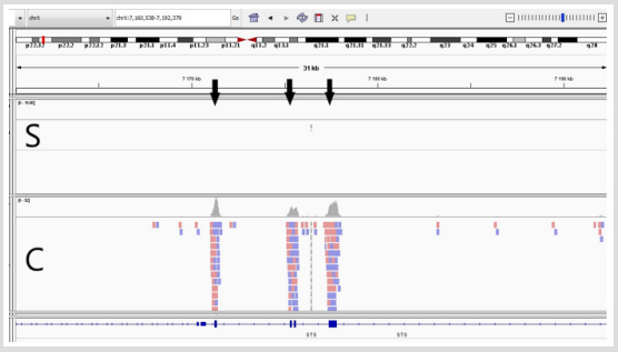 Click here to view Large Figure 3 biomedres-openaccess-journal-bjstr