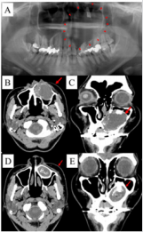 biomedres-openaccess-journal-bjstr