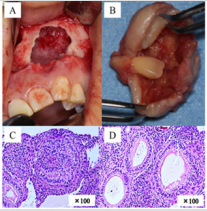 biomedres-openaccess-journal-bjstr