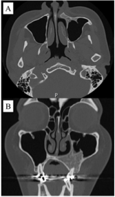 biomedres-openaccess-journal-bjstr