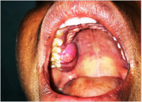 biomedres-openaccess-journal-bjstr
