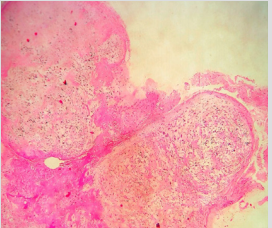 biomedres-openaccess-journal-bjstr