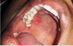 biomedres-openaccess-journal-bjstr