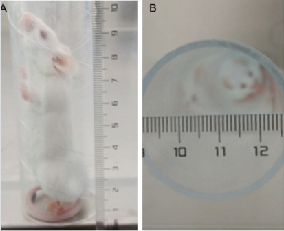 biomedres-openaccess-journal-bjstr