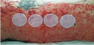 biomedres-openaccess-journal-bjstr