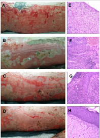 biomedres-openaccess-journal-bjstr