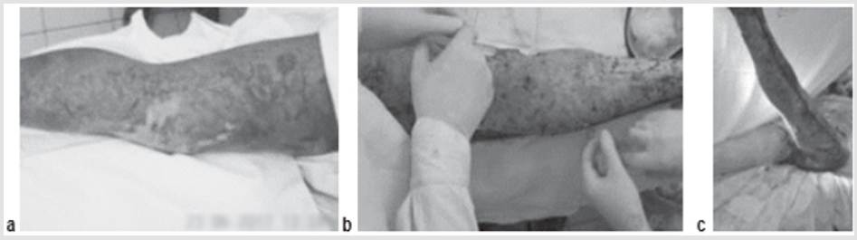 biomedres-openaccess-journal-bjstr