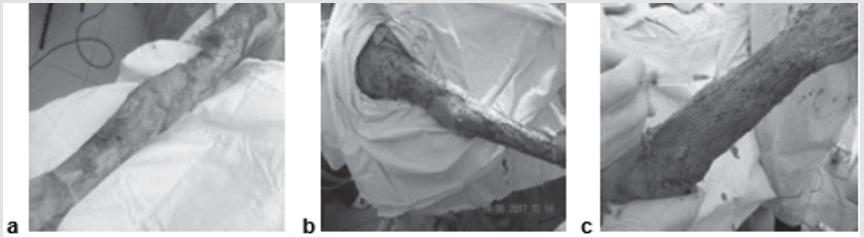 biomedres-openaccess-journal-bjstr