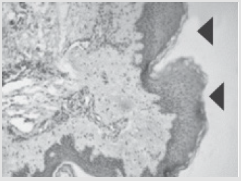 biomedres-openaccess-journal-bjstr