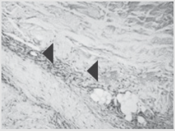 biomedres-openaccess-journal-bjstr