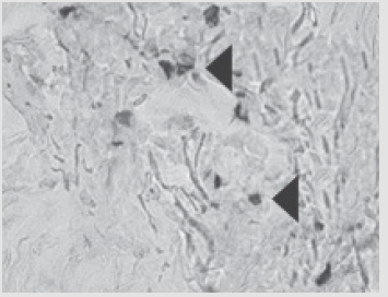 biomedres-openaccess-journal-bjstr
