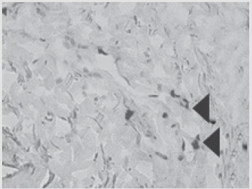 biomedres-openaccess-journal-bjstr