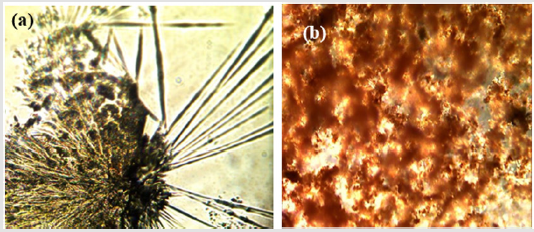 Click here to view Large Figure 3 biomedres-openaccess-journal-bjstr