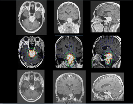 biomedres-openaccess-journal-bjstr