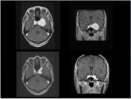 biomedres-openaccess-journal-bjstr
