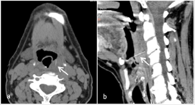 biomedres-openaccess-journal-bjstr