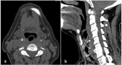 biomedres-openaccess-journal-bjstr